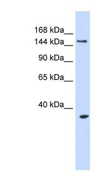 Western Blot: UBE3B Antibody [NBP1-54950] - 293T cells lysate, concentration 0.2-1 ug/ml.