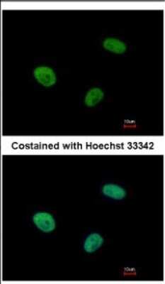 Immunocytochemistry/Immunofluorescence: UBE3C Antibody [NBP2-20790] - Immunofluorescence analysis of paraformaldehyde-fixed HeLa, using antibody at 1:500 dilution.