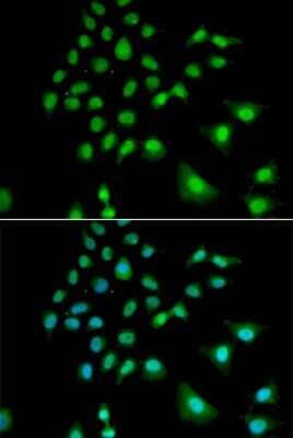 Immunocytochemistry/Immunofluorescence: UBE3C Antibody [NBP2-94023] - Analysis of U2OS cells using UBE3C . Blue: DAPI for nuclear staining.