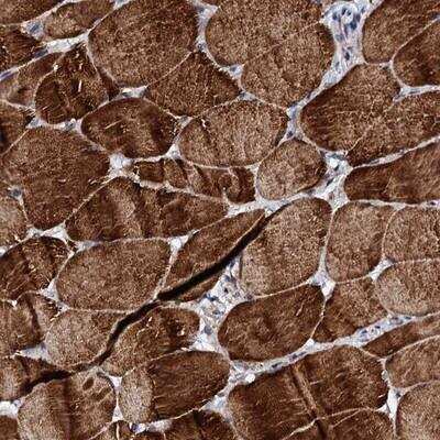 Immunohistochemistry-Paraffin: UBE3C Antibody [NBP1-81558] - Staining of human skeletal muscle shows strong cytoplasmic positivity in myocytes.