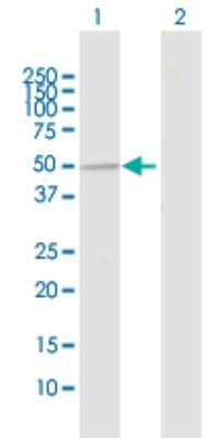 Western Blot: UBE3C Antibody [H00009690-D01P] - Analysis of UBE3C expression in transfected 293T cell line by UBE3C polyclonal antibody.Lane 1: UBE3C transfected lysate(45.80 KDa).Lane 2: Non-transfected lysate.