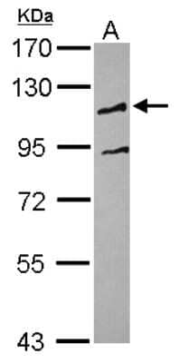 Western Blot: UBE3C Antibody [NBP2-20790] - Sample (30 ug of whole cell lysate) A: HepG2 7. 5% SDS PAGE gel, diluted at 1:1000.