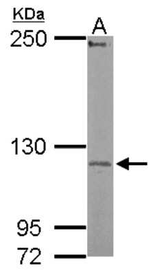 Western Blot: UBE3C Antibody [NBP2-20790] - Sample (50 ug of whole cell lysate) A: Mouse Brain, 5% SDS PAGE gel, diluted at 1:500.