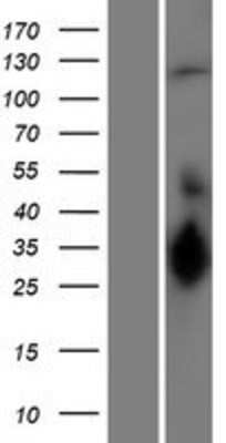 Western Blot: UBE3C Overexpression Lysate (Adult Normal) [NBP2-07298] Left-Empty vector transfected control cell lysate (HEK293 cell lysate); Right -Over-expression Lysate for UBE3C.