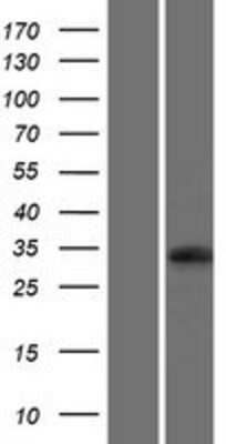 Western Blot: UBFD1 Overexpression Lysate (Adult Normal) [NBP2-06717] Left-Empty vector transfected control cell lysate (HEK293 cell lysate); Right -Over-expression Lysate for UBFD1.
