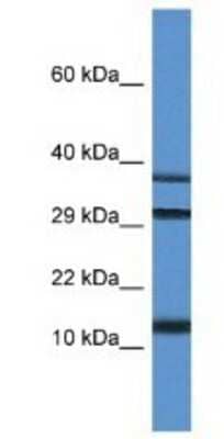Western Blot: UBL3 Antibody [NBP1-74174] - Rat Kidney Lysate 1ug/ml  Gel Concentration 10-20%