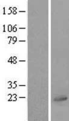 Western Blot: UBL4A Overexpression Lysate (Adult Normal) [NBL1-17554] Left-Empty vector transfected control cell lysate (HEK293 cell lysate); Right -Over-expression Lysate for UBL4A.