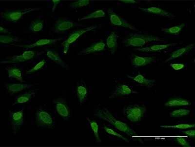 Immunocytochemistry/Immunofluorescence: UBL7 Antibody [H00084993-B01P] - Analysis of purified antibody to UBL7 on HeLa cell. (antibody concentration 10 ug/ml)