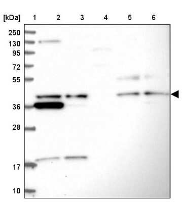 Western Blot: UBL7 Antibody [NBP1-88566] - Lane 1: Marker  [kDa] 250, 130, 95, 72, 55, 36, 28, 17, 10.  Lane 2: Human cell line RT-4.  Lane 3: Human cell line U-251MG sp.  Lane 4: Human plasma (IgG/HSA depleted).  Lane 5: Human liver tissue.  Lane 6: Human tonsil tissue