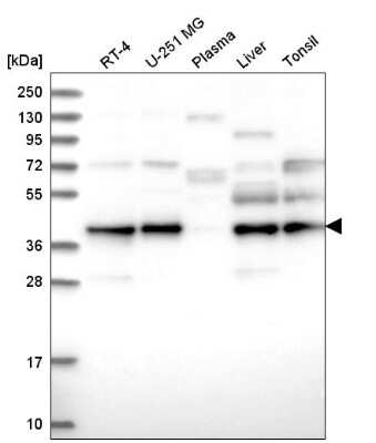 Western Blot: UBL7 Antibody [NBP2-58983] - Western blot analysis in human cell line RT-4, human cell line U-251 MG, human plasma, human liver tissue and human tonsil tissue.