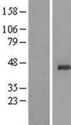 Western Blot: UBL7 Overexpression Lysate (Adult Normal) [NBP2-04621] Left-Empty vector transfected control cell lysate (HEK293 cell lysate); Right -Over-expression Lysate for UBL7.