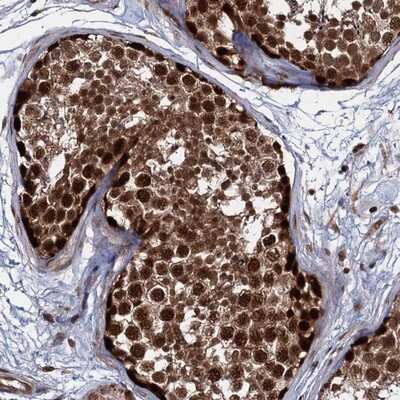Immunohistochemistry-Paraffin: UBLCP1 Antibody [NBP1-85468] - Staining of human testis shows strong nuclear positivity in cells of seminiferus ducts.