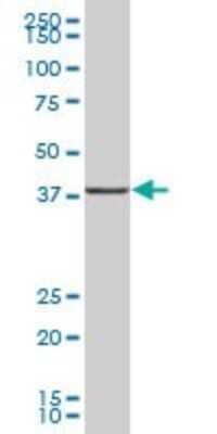 Western Blot: UBLCP1 Antibody [H00134510-B01P] - Analysis of UBLCP1 expression in human placenta.
