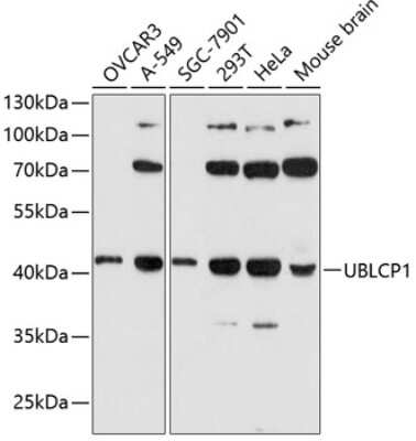 Western Blot: UBLCP1 Antibody [NBP2-94630] - Analysis of extracts of various cell lines, using UBLCP1 at 1:3000 dilution. Secondary antibody: HRP Goat Anti-Rabbit IgG (H+L) at 1:10000 dilution. Lysates/proteins: 25ug per lane. Blocking buffer: 3% nonfat dry milk in TBST. Detection: ECL Basic Kit . Exposure time: 90s.