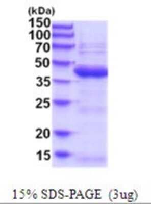 SDS-PAGE Recombinant Human UBLCP1 His Protein