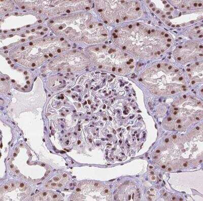 Immunohistochemistry-Paraffin: UBN1 Antibody [NBP2-49579] - Staining of human kidney shows moderate to strong nuclear positivity in cells in tubules.
