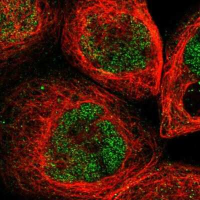 Immunocytochemistry/ Immunofluorescence UBN2 Antibody - BSA Free