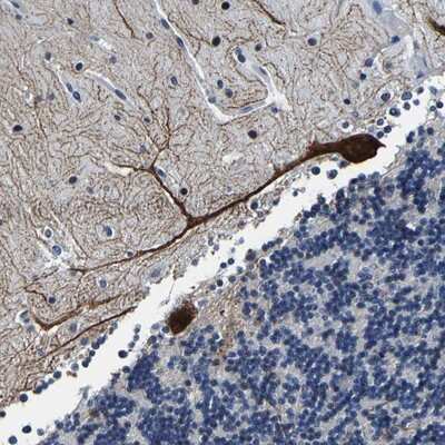 Immunohistochemistry-Paraffin UBN2 Antibody - BSA Free