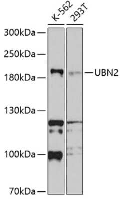Western Blot: UBN2 Antibody [NBP2-94169] - Analysis of extracts of various cell lines, using UBN2 at 1:1000 dilution. Secondary antibody: HRP Goat Anti-Rabbit IgG (H+L) at 1:10000 dilution. Lysates/proteins: 25ug per lane. Blocking buffer: 3% nonfat dry milk in TBST. Detection: ECL Basic Kit . Exposure time: 90s.