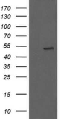Western Blot: UBOX5 Antibody (OTI8D5) - Azide and BSA Free [NBP2-74757] - Analysis of HEK293T cells were transfected with the pCMV6-ENTRY control (Left lane) or pCMV6-ENTRY UBOX5.