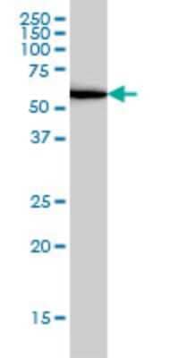 Western Blot: UBP1 Antibody (1C5) [H00007342-M01] - UBP1 monoclonal antibody (M01), clone 1C5 Analysis of UBP1 expression in IMR-32.