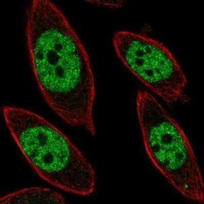 Immunocytochemistry/Immunofluorescence: UBP1 Antibody [NBP1-82842] - Staining of human cell line PC-3 shows localization to nucleoplasm. Antibody staining is shown in green.