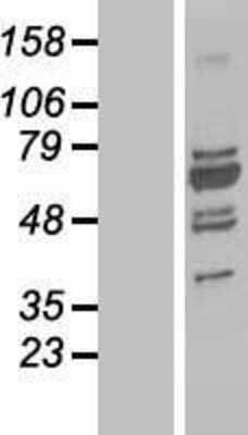 Western Blot UBP1 Overexpression Lysate