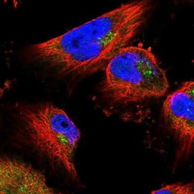 Immunocytochemistry/Immunofluorescence: UBPY/USP8 Antibody [NBP2-55627] - Staining of human cell line U-251 MG shows localization to cytosol & the Golgi apparatus.