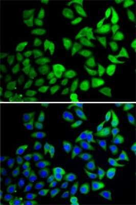 Immunocytochemistry/Immunofluorescence: UBPY/USP8 Antibody [NBP2-94523] - Immunofluorescence analysis of A-549 cells using UBPY/USP8 antibody (NBP2-94523). Blue: DAPI for nuclear staining.