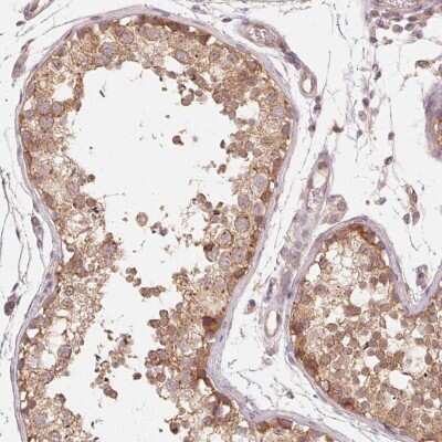 Immunohistochemistry-Paraffin: UBPY/USP8 Antibody [NBP2-55627] - Staining of human testis shows strong cytoplasmic positivity in subset of cells in seminiferous ducts.