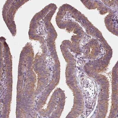 Immunohistochemistry-Paraffin: UBPY/USP8 Antibody [NBP2-55627] - Staining of human fallopian tube shows moderate positivity in apical membrane in glandular cells.