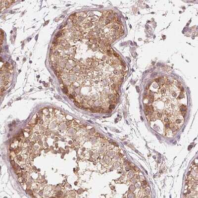 Immunohistochemistry-Paraffin: UBPY/USP8 Antibody [NBP2-55627] - Staining of human testis shows moderate cytoplasmic positivity in cells in seminiferous ducts.