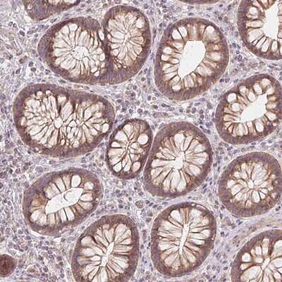 Immunohistochemistry-Paraffin: UBPY/USP8 Antibody [NBP2-55627] - Staining of human colon shows moderate membranous and cytoplasmic positivity in glandular cells.