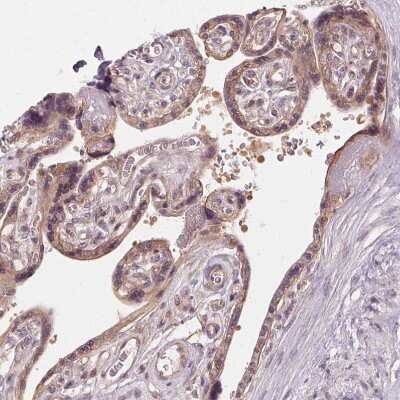 Immunohistochemistry-Paraffin: UBPY/USP8 Antibody [NBP2-55627] - Staining of human placenta shows moderate cytoplasmic and membranous positivity in trophoblastic cells.