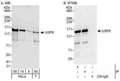 Western Blot: UBPY/USP8 Antibody [NBP1-50001] - Detection of Human USP8 by Western Blot and Immunoprecipitation.  Samples: Whole cell lysate from HeLa (5, 15 and 50 mcg for WB; 1 mg for IP, 20% of IP loaded) and 293T (T; 50 mcg) cells.  Antibodies: Affinity purified rabbit anti-USP8 antibody used for WB at 0.04 mcg/ml (A) and 0.4 mcg/ml (B) and used for IP at 3 mcg/mg lysate.  USP8 was also immunoprecipitated by rabbit anti-USP8 antibody which recognizes a downstream epitope.  For blotting immunoprecipitated USP8, the ReliaBLOT(R)  Reagents and Procedures were used.   Detection: Chemiluminescence with exposure times of 3 minutes (A) and 10 seconds (B).