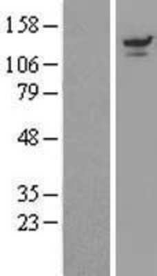 Western Blot: UBPY/USP8 Overexpression Lysate (Adult Normal) [NBP2-11118] Left-Empty vector transfected control cell lysate (HEK293 cell lysate); Right -Over-expression Lysate for UBPY/USP8.