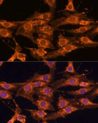 Immunocytochemistry/Immunofluorescence: UBQLNL Antibody [NBP2-93837] - Analysis of C6 cells using UBQLNL at dilution of 1:100. Blue: DAPI for nuclear staining.