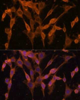Immunocytochemistry/Immunofluorescence: UBQLNL Antibody [NBP2-93837] - Analysis of NIH/3T3 cells using UBQLNL at dilution of 1:100. Blue: DAPI for nuclear staining.