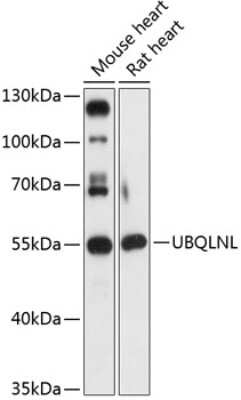 Western Blot: UBQLNL Antibody [NBP2-93837] - Analysis of extracts of various cell lines, using UBQLNL at 1:3000 dilution. Secondary antibody: HRP Goat Anti-Rabbit IgG (H+L) at 1:10000 dilution. Lysates/proteins: 25ug per lane. Blocking buffer: 3% nonfat dry milk in TBST. Detection: ECL Basic Kit . Exposure time: 30s.