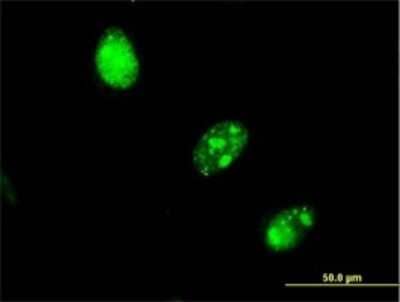 Immunocytochemistry/Immunofluorescence: UBR4 Antibody (2D12) [H00023352-M01] - Analysis of monoclonal antibody to RBAF600 on HeLa cell. Antibody concentration 10 ug/ml.