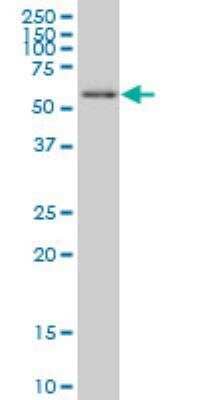 Western Blot UBR4 Antibody (2D12)