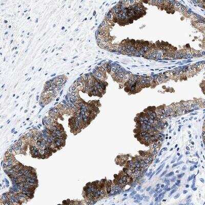 Immunohistochemistry-Paraffin: UBR4 Antibody [NBP1-83003] - Staining of human prostate shows strong cytoplasmic positivity in glandular cells.