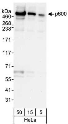 Western Blot UBR4 Antibody