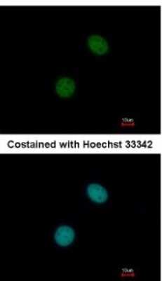 Immunocytochemistry/Immunofluorescence: UBR7 Antibody [NBP2-20794] - Analysis of paraformaldehyde-fixed MCF-7, using antibody at 1:200 dilution.