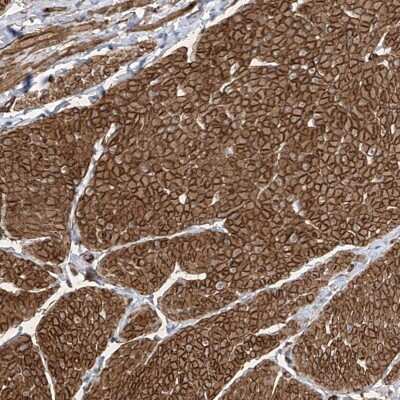 Immunohistochemistry-Paraffin: UBTD1 Antibody [NBP1-82311] - Staining of human smooth muscle shows strong cytoplasmic and membranous positivity in smooth muscle cells.