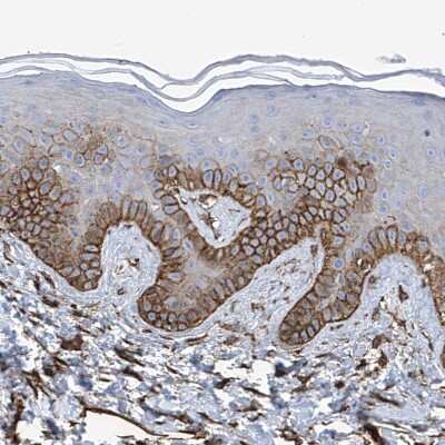Immunohistochemistry-Paraffin: UBTD1 Antibody [NBP1-82311] - Staining of human skin shows moderate to strong membranous positivity in keratinocytes.