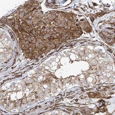 Immunohistochemistry-Paraffin: UBTD1 Antibody [NBP1-82311] - Staining of human testis shows moderate to strong membranous positivity in Leydig cells.
