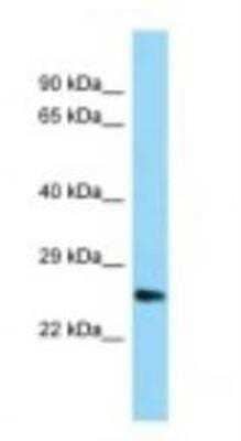 Western Blot: UBTD1 Antibody [NBP1-98480] - Rat Muscle Lysate 1.0ug/ml, Gel Concentration: 12%