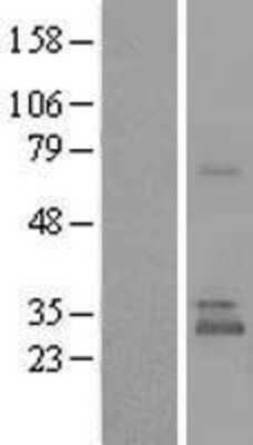 Western Blot: UBTD1 Overexpression Lysate (Adult Normal) [NBL1-17569] Left-Empty vector transfected control cell lysate (HEK293 cell lysate); Right -Over-expression Lysate for UBTD1.