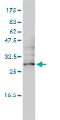 Western Blot UBTD2 Antibody (1B8-1B1) - Azide and BSA Free